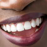 55469156-macro-close-up-of-african-female-mouth-showing-perfect-white-teeth